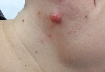 Подбородок