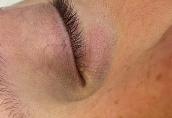 Область глаза